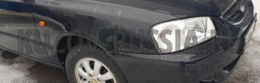 Кузовной ремонт и покраска бампера и крыльев Hyundai Accent