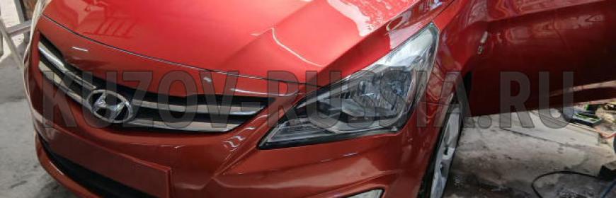 Кузовной ремонт и покраска Hyundai Solaris